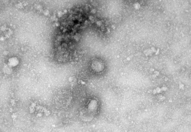 Canadá lograr aislar al patógeno, coronavirus 10 Screenshot 1 12